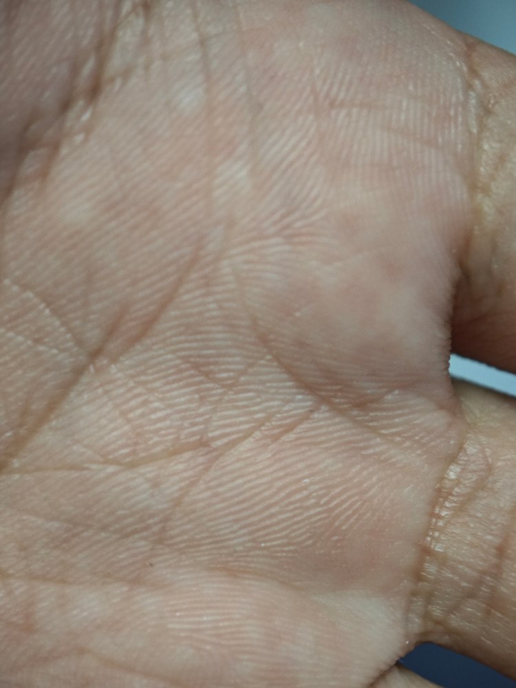 皮膚表面まで鮮明